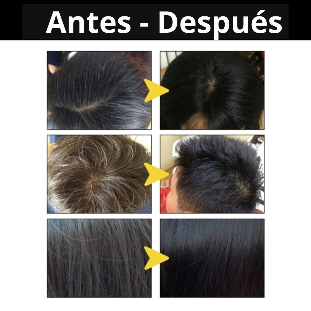 Shampoo Mágico 3 en 1 - ADIOS A LAS CANAS